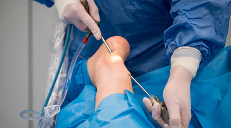 Cirugía articular
